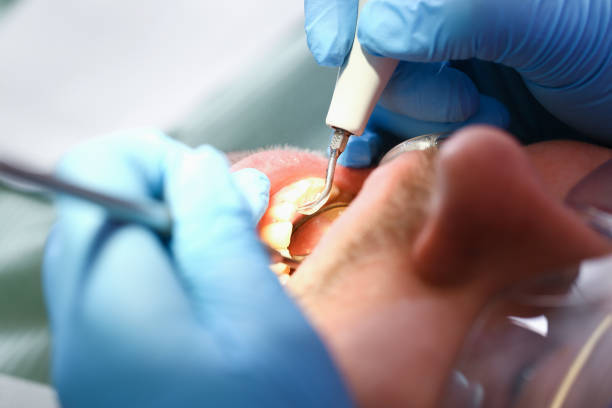Best Emergency Gum Treatment in Eagle Point, OR