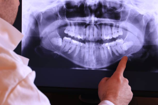Best Emergency Dental Care for Broken or Chipped Teeth in Eagle Point, OR